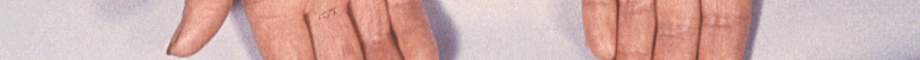 allergy banner